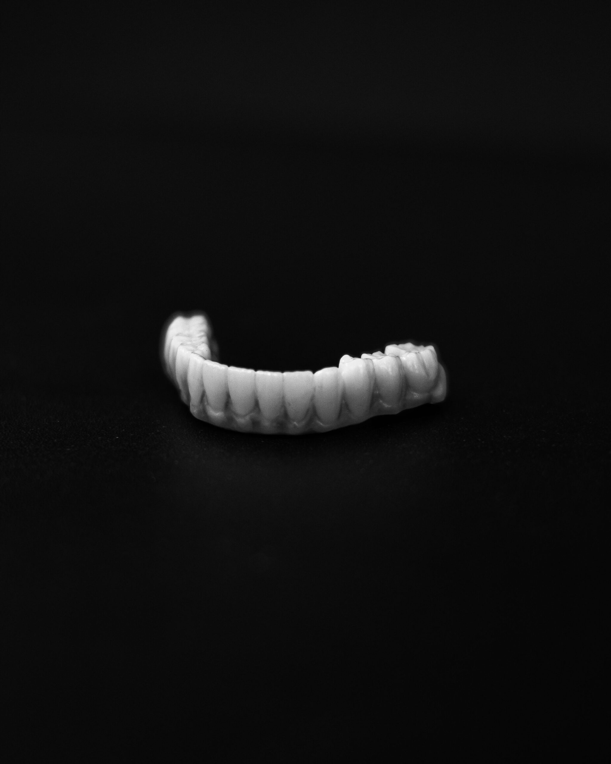 Sobredentadura